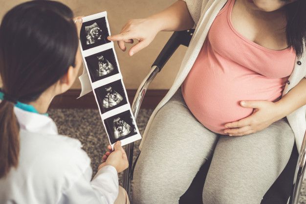 a909bbe36b379b32ccb6277f453be58b